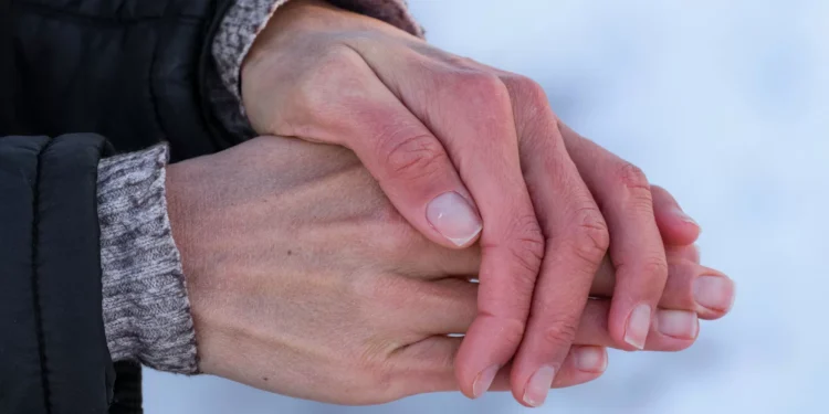 Pele macia no inverno é difícil. Dermatologista explica as razões