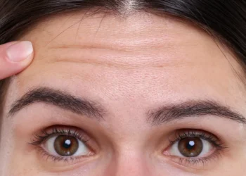 Doenças do coração notam-se na testa? Cuidado com este sinal de alerta