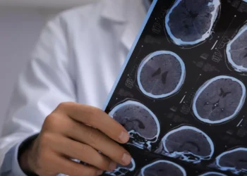 Novo tratamento contra esclerose múltipla pode estar a caminho