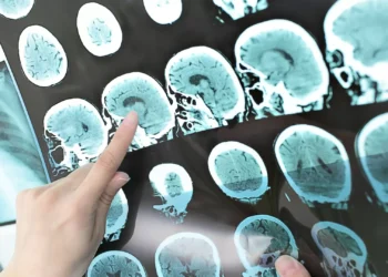 Algarve distinguido pela sua capacidade em detetar e tratar casos de AVC