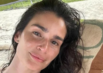 ‘O diagnóstico de esclerose múltipla me ensinou a ser menos controladora’, diz a top model Carol Ribeiro