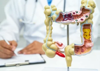 Estes sete alimentos podem prejudicar (muito) a saúde do seu intestino