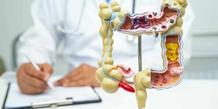 Estes sete alimentos podem prejudicar (muito) a saúde do seu intestino