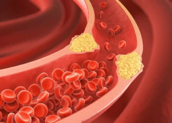 Seis alimentos que ajudam (e muito) a desobstruir as suas artérias