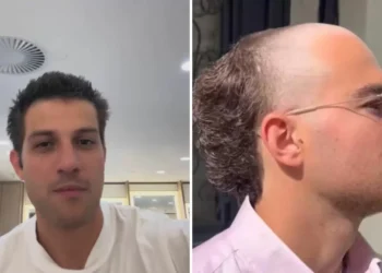 A moda dos calvos: tendência que vai contra homens ‘penteados’