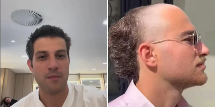 A moda dos calvos: tendência que vai contra homens ‘penteados’