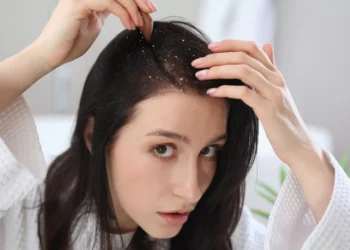 Dormir com cabelo molhado aumenta caspa? Especialista responde