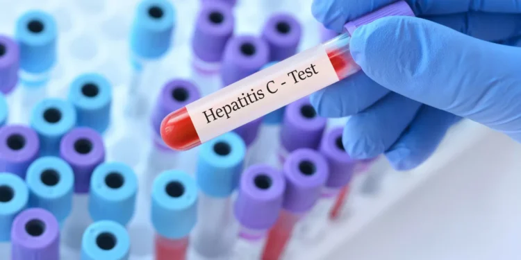 Novo estudo observa ligação entre o vírus da hepatite C e a esquizofrenia