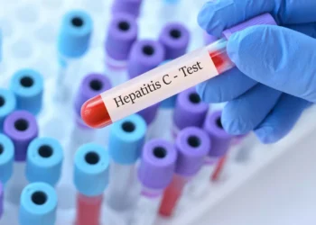 Novo estudo observa ligação entre o vírus da hepatite C e a esquizofrenia