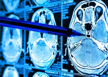 Descoberta sobre glicose no cérebro pode ajudar a combater Alzheimer