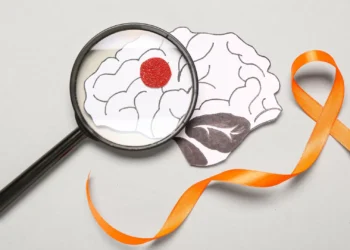 Cinco sintomas que podem prever esclerose múltipla até 15 anos antes