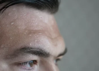 O seu rosto está sempre suado? Estes podem ser os motivos